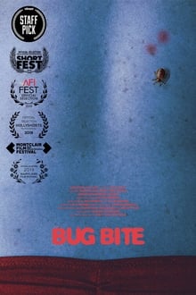 Bug Bite