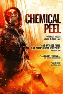 Chemical Peel