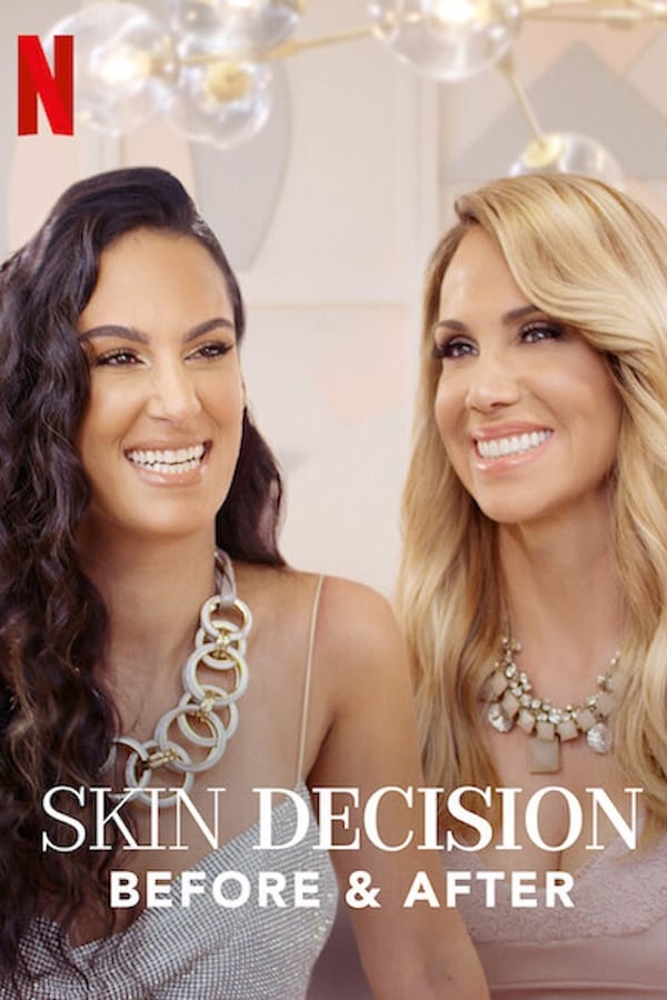 Skin decision: prima e dopo